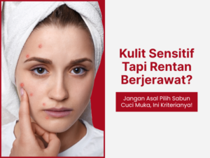 Kulit Sensitif Tapi Rentan Jerawat?